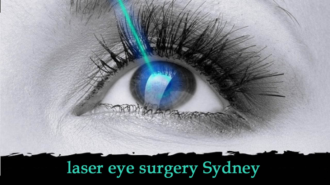 laser eye surgery Sydney