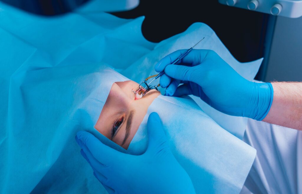 Lasik Surgery